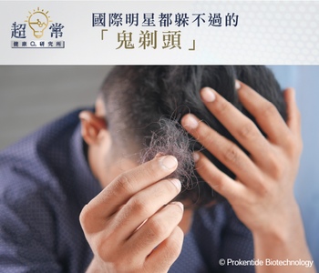 【超日常健康研究所】國際明星都躲不過的「鬼剃頭」
